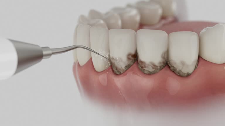 Reliable Emergency Dentist contractor in Chackbay, LA by Smile Center Dentistry